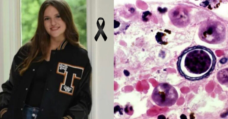 Adolescente tem morte confirmada após mais um caso de ‘ameba comemora de cérebro’