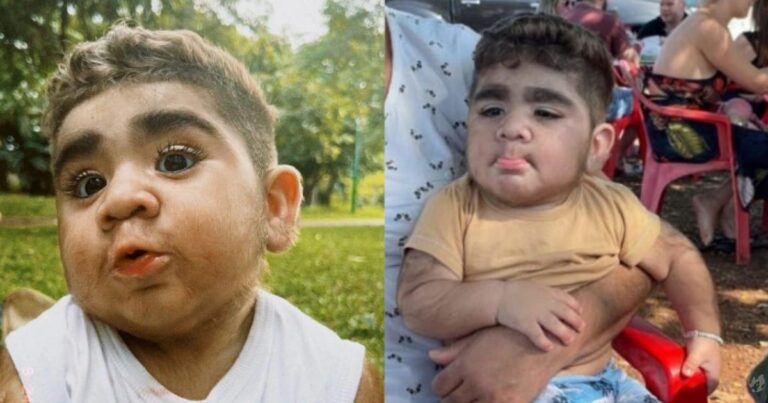 Bebê brasileiro que nasceu com barba viraliza no TikTok