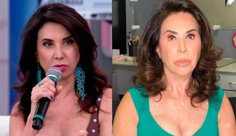 Entre a vida e a morte: saiba como está Claudia Alencar após quadro grave