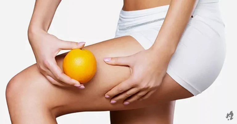 Celulite tem cura? Os cosméticos realmente ajudam a combatê-la?