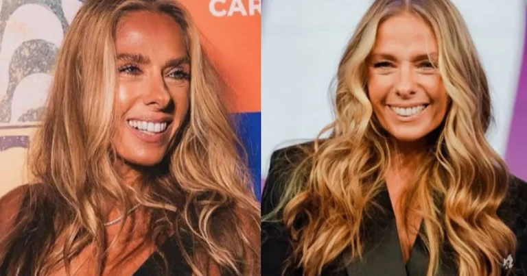 Conheça a doença degenerativa que pode deixar Adriane Galisteu com sequelas