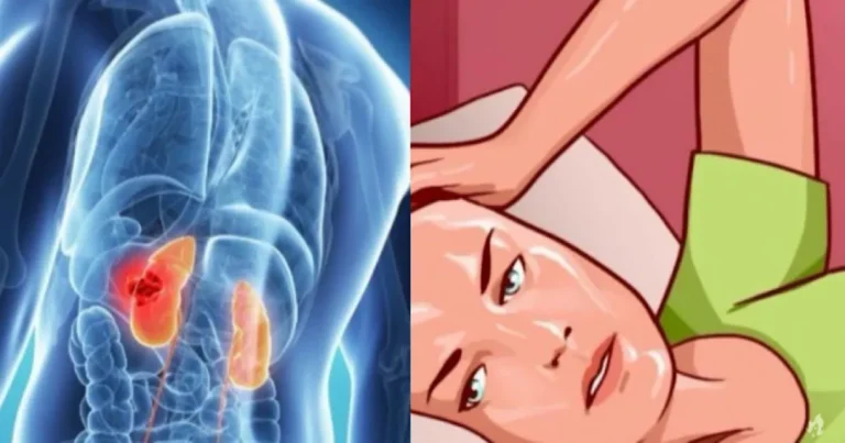 Você sente isso durante a noite? Fique em alerta, pois pode significar um sintoma de câncer no rim