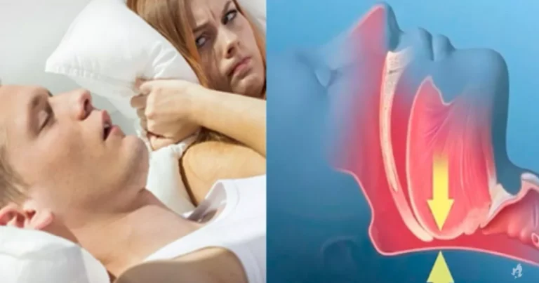 Os perigos ocultos da apneia do sono: 6 sinais de alerta que você não pode ignorar