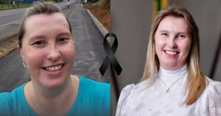 Prefeita de SC perde a perna após trombose, estes foram os sintomas que ela sentiu: “Vontade De…