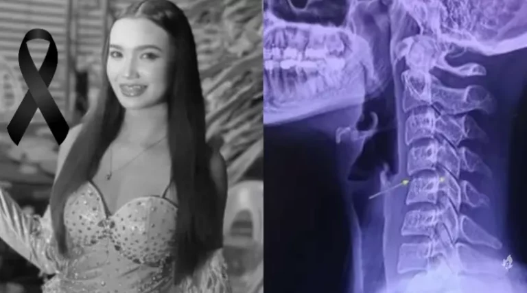 Cantora de 20 anos morre após passar por sessão de massagem