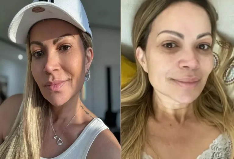 Médica entrega detalhe de tratamento para vício de Solange Almeida: ‘Depende da gravidade’