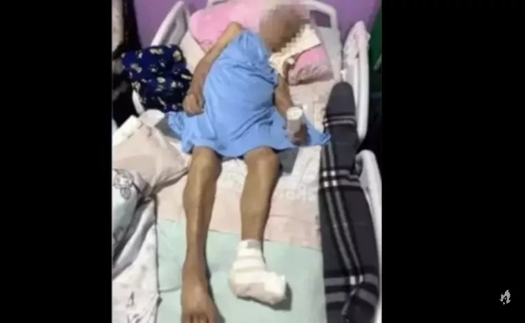 Idosa de 103 anos tem pé amputado em casa por enfermeira e sem anestesia