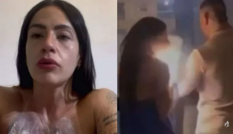 Turista faz desabafo doloroso após ser atingida por fogos de artifício em SC: “queimaduras de 2º e 3º grau”