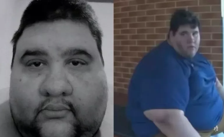 Causa do óbito do influenciador que lutava contra a obesidade é exposta; ele chegou a 380 kg após perder o pai e o irmão