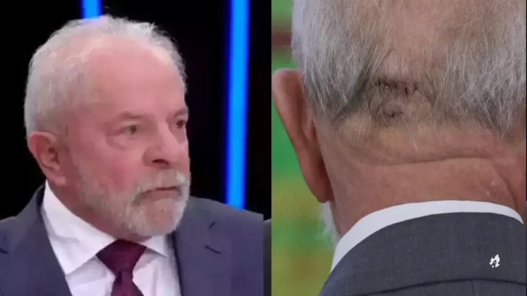 Lula faz novo exame, resultado vem à tona e médicos tomam decisão importante