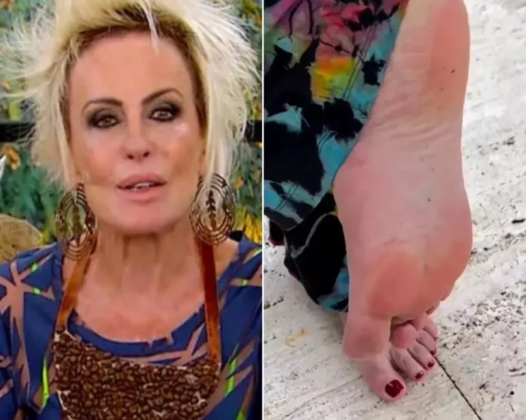 Ana Maria Braga fala pela 1ª vez após ser picada por escorpião