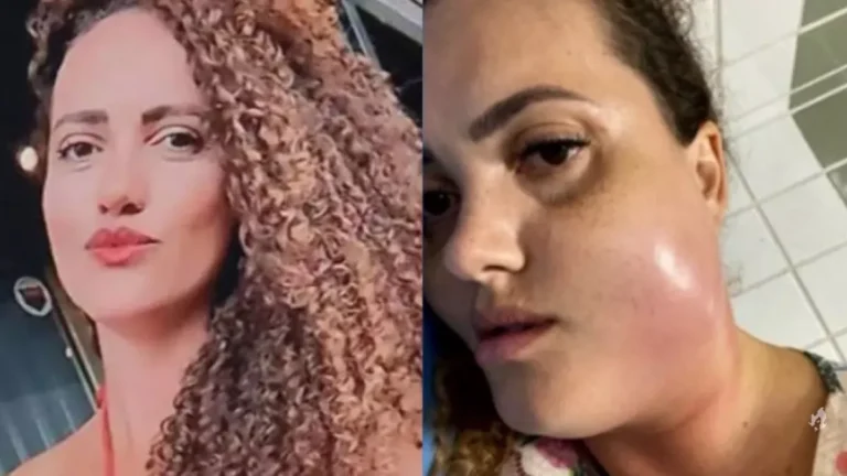 Mulher morre após infecção generalizada provocada por raspagem gengival