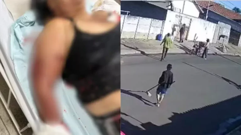 Avó atacada por pitbull isolou neta bebê e precisou trancar porta para evitar mordidas