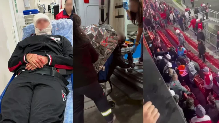 Jovem tem alta após cirurgia na cabeça devido à queda de placa no Morumbis