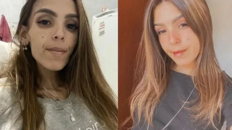 Morre jovem que lutava contra doença rara, tinha desnutrição severa e pesava 27kg aos 22 anos