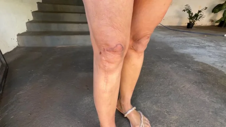 Mulher arrastada pelos cabelos em posto diz que namorado a agrediu por causa de roupa curta: Não deixa usar short-saia
