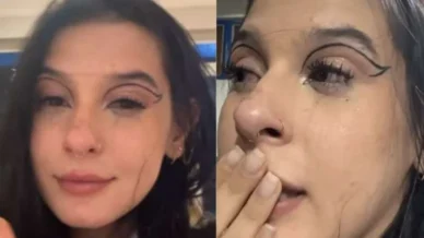 Após críticas, Ana Castela passa por cirurgia e especialista alerta: Extremamente precisa