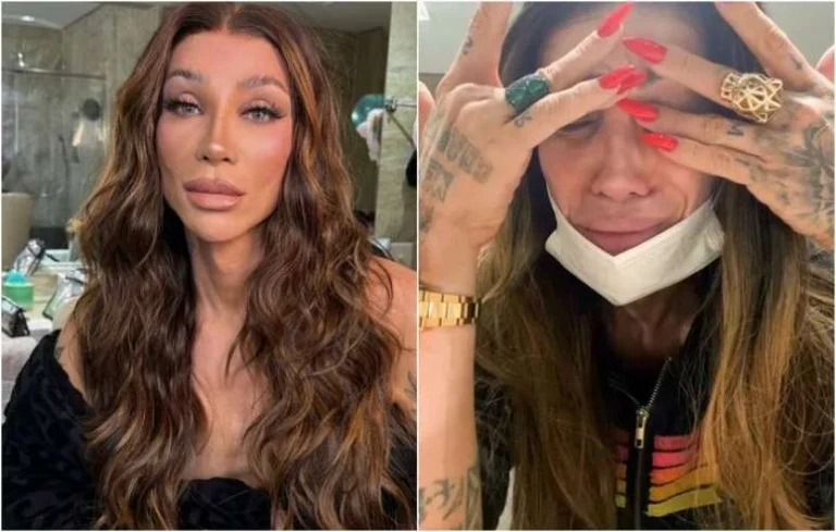 Maya Massafera mostra rosto infeccionado após cirurgia no maxilar: Não consigo parar de chorar