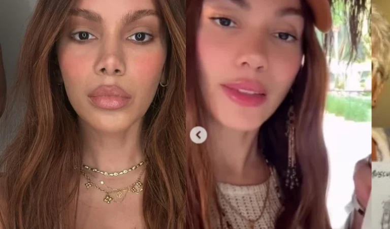 Anitta mexeu no nariz, de novo? Web aponta nova rinoplastia e mudança no rosto da cantora após fotos e vídeos com a xamã Max Tovar. Compare!