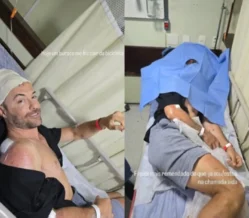 Kayky Brito sofre acidente de bicicleta e leva pontos na cabeça após cair em buraco: Fiquei mais remendado