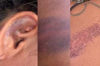 PMs são afastados após denúncia de agressão contra advogada durante festa no RN