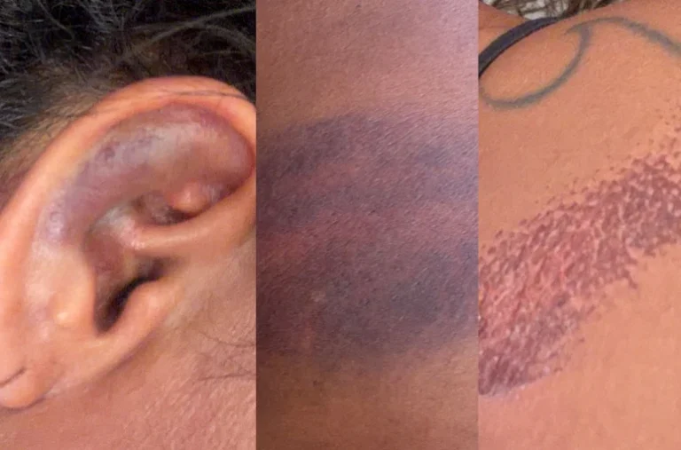 PMs são afastados após denúncia de agressão contra advogada durante festa no RN