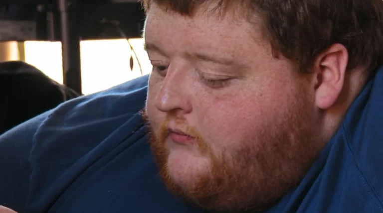 “Quilos Mortais”: veja o antes e depois de Justin, que pesava 311 kg