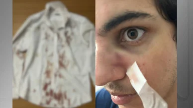 Turista é assaltado e agredido durante Festival Virada Salvador, na Bahia