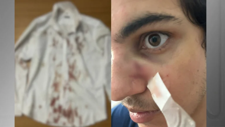 Turista é assaltado e agredido durante Festival Virada Salvador, na Bahia