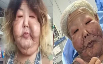 Juju do Pix reaparece após cirurgia no rosto e resultado divide opiniões