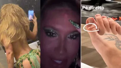 Virginia mostra machucados pelo corpo após ensaio na Grande Rio