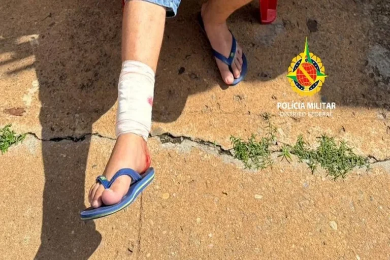 Pit bull é morto pela PM após atacar pessoas e matar cadela no DF