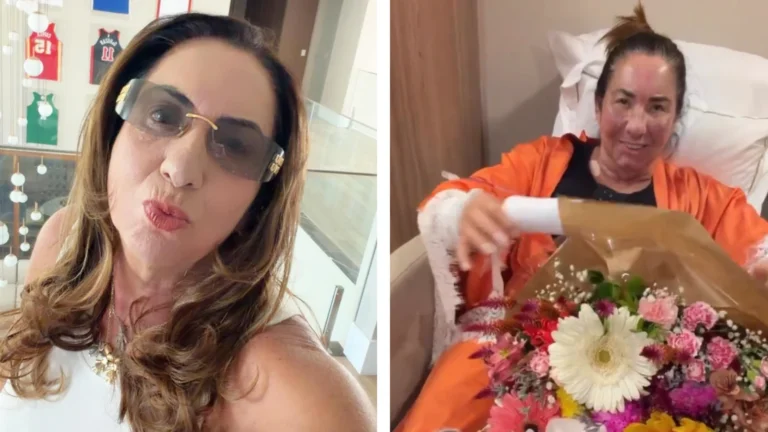 Mãe de Virginia faz procedimentos estéticos e é lembrada por Zé Felipe