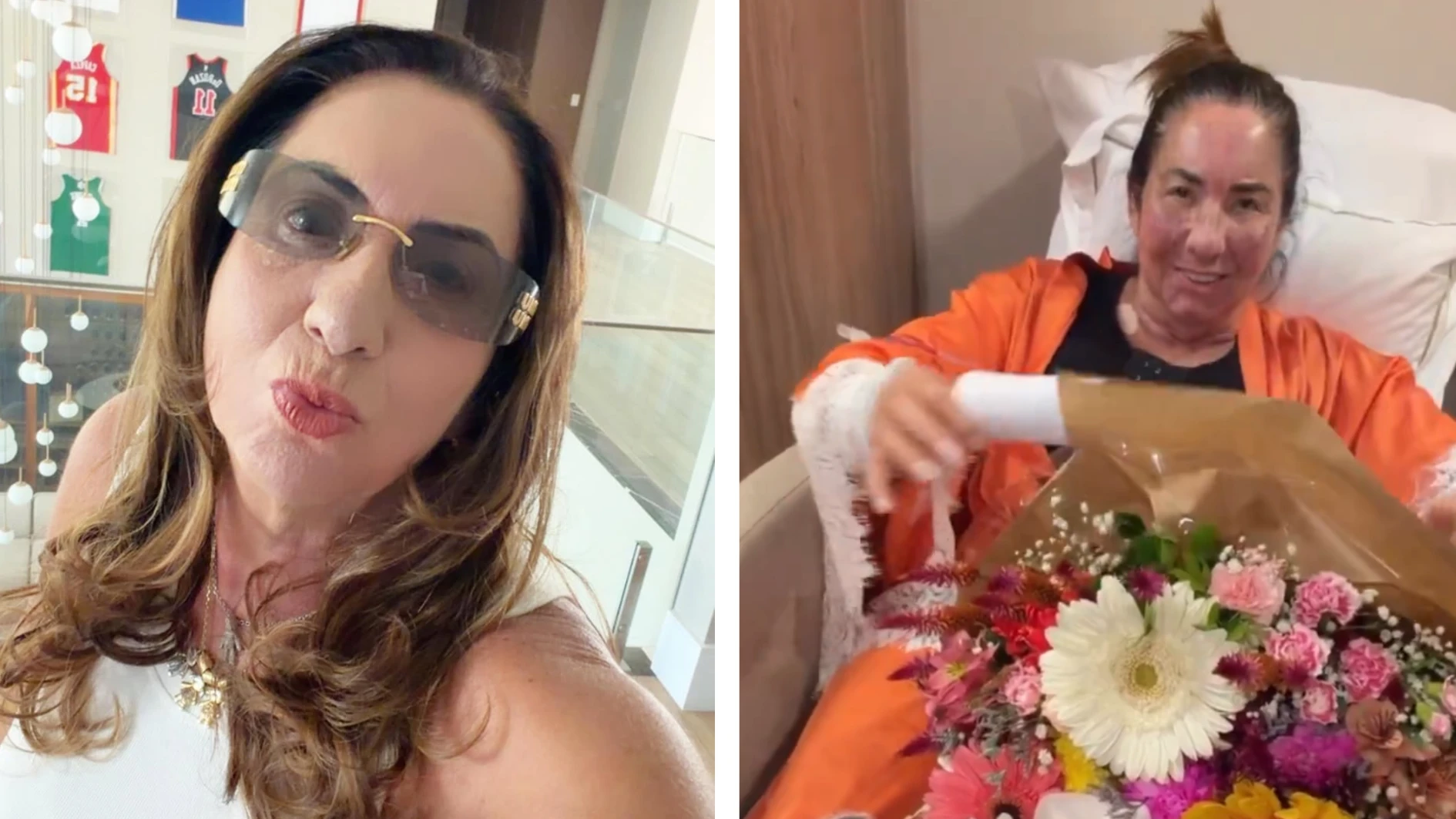 Mãe de Virginia faz procedimentos estéticos e é lembrada por Zé Felipe