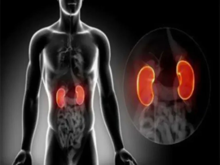 5 sinais silenciosos de doença renal crônica que jamais devem ser ignorados, segundo nefrologista