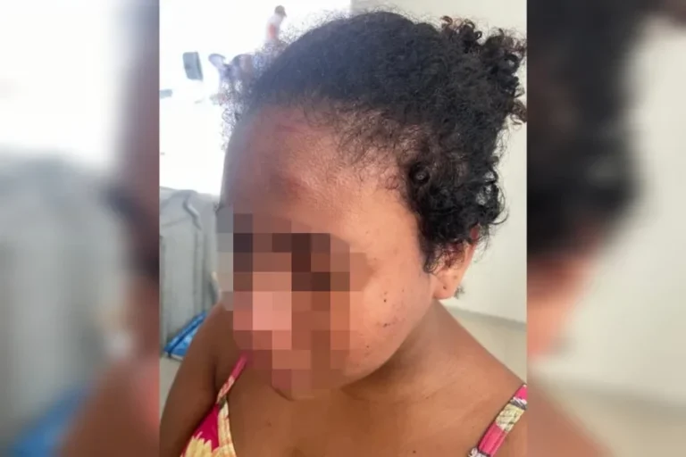 “Espero que pague pelo que fez”, diz doméstica torturada por patroa