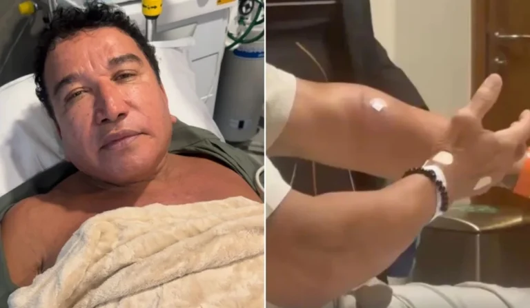 Magno Malta quebra o protocolo e se manifesta após ser acusado de agressão em exame: ‘Um dedo…’