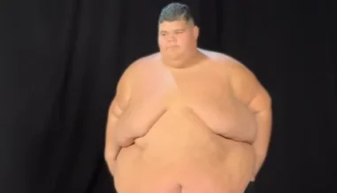 Gordão da XJ emagrece 130 kg e mostra antes e depois; veja