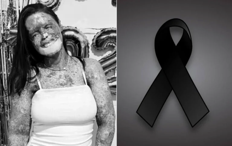 Influencer morre após longa batalha contra doença rara e comove seguidores