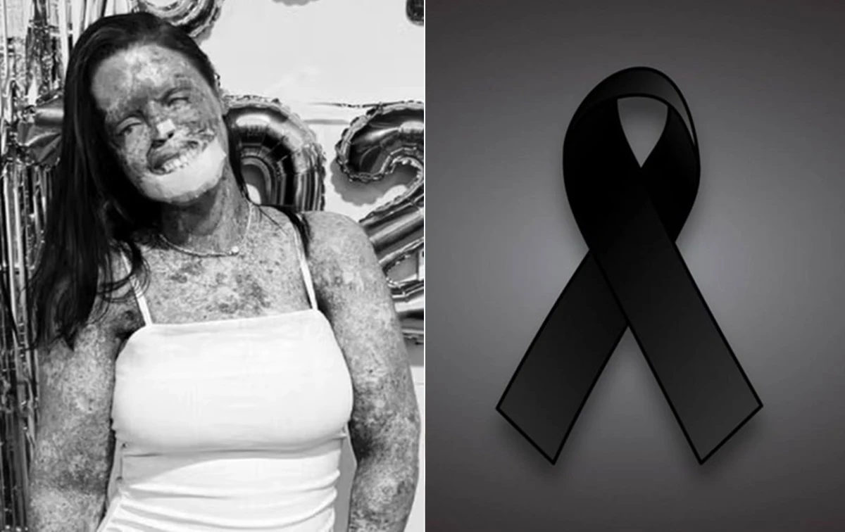Influencer morre após longa batalha contra doença rara e comove seguidores
