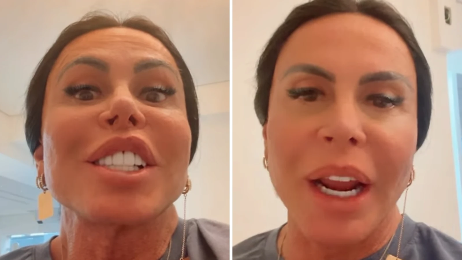 Gretchen rebate críticas sobre procedimento: 