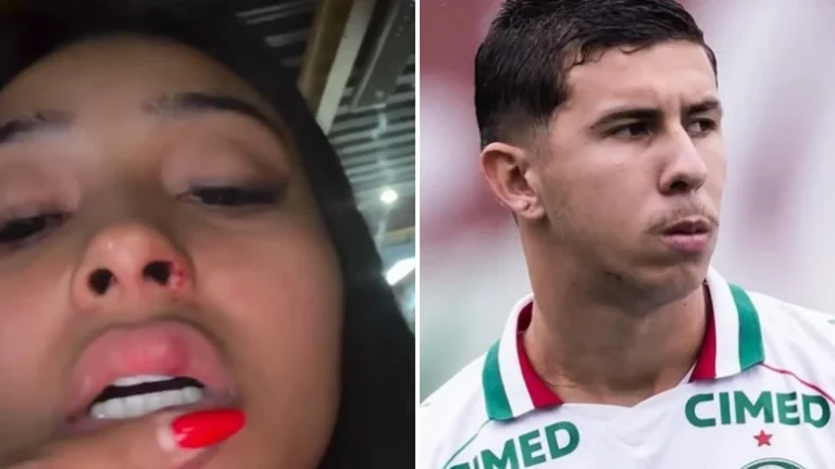 Ex-mulher de jogador do Palmeiras relata agressão e pede Justiça